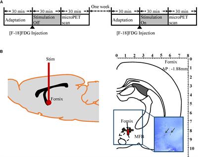 Fornix Stimulation Induces Metabolic Activity and Dopaminergic Response in the Nucleus Accumbens